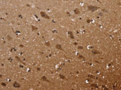 FANCF Antibody