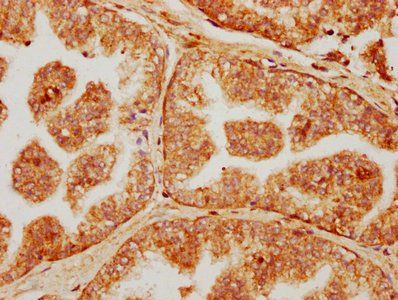 FAR1 Antibody