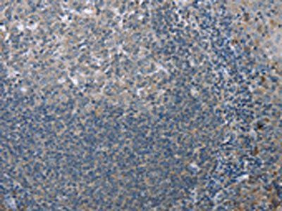 FAR2 Antibody