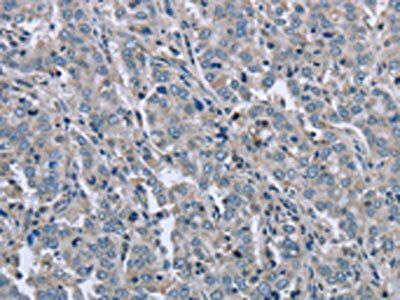 FAR2 Antibody