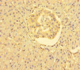 FARP2 Antibody