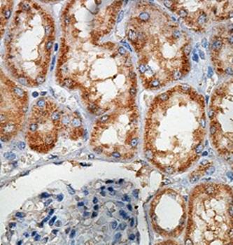 FARS2 Rabbit Polyclonal Antibody