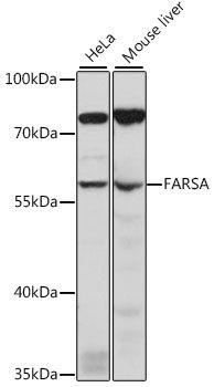 FARSA antibody