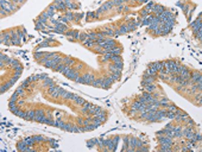 FARSB Antibody