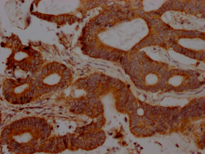 FAS Recombinant Monoclonal Antibody