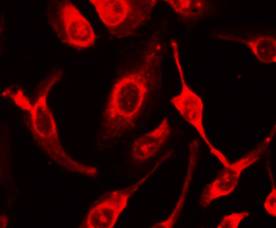 Anti-Fas Antibody