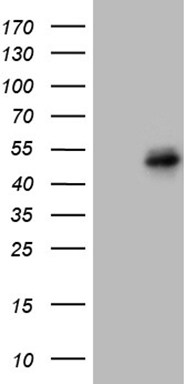 Fascin (FSCN1) antibody