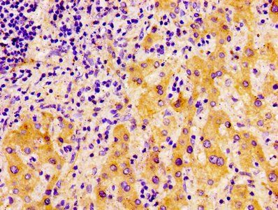 FASN Antibody