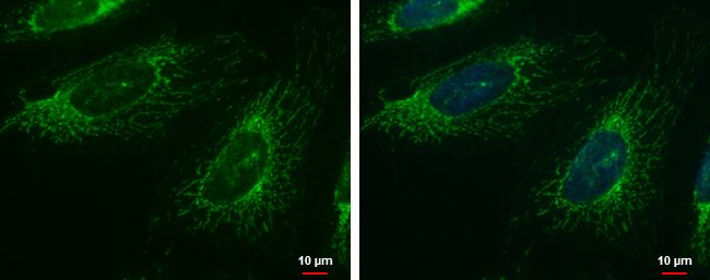 Fas activated serine/threonine kinase Antibody