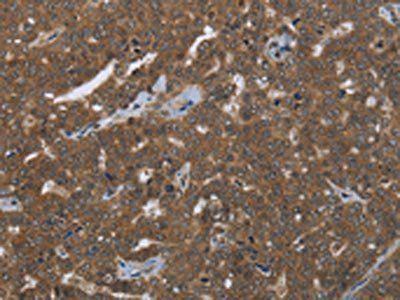FASTKD1 Antibody
