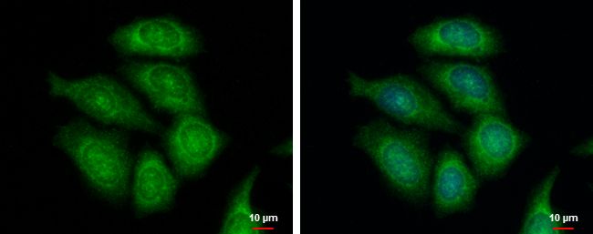 FASTKD1 antibody [C1C3]
