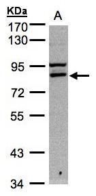 FASTKD1 Rabbit Polyclonal Antibody