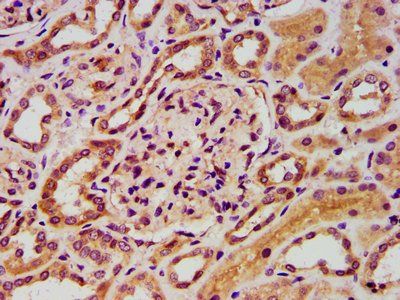 FASTKD5 Antibody