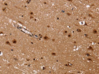 FASTKD5 Antibody