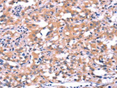 FAT1 Antibody