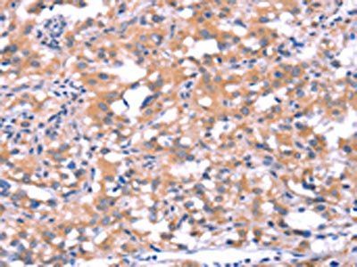 FAT1 antibody