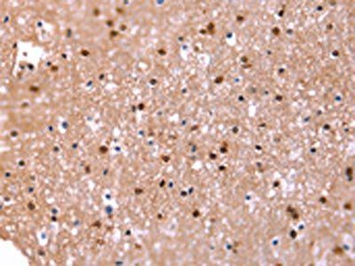 FAT1 Antibody