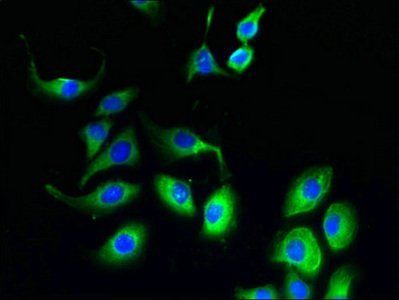 FATE1 Antibody