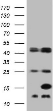 Fatty Acid Binding Protein 5 (FABP5) antibody