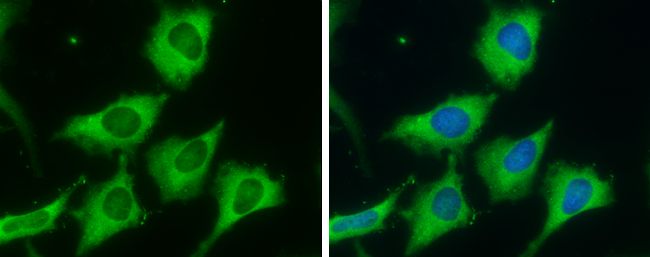 Fatty Acid Synthase antibody [N1], N-term