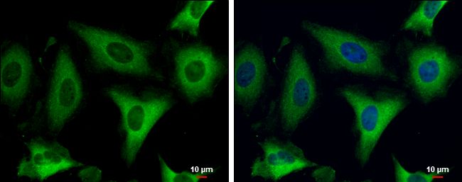 Fatty Acid Synthase antibody