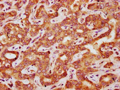 FAU Antibody