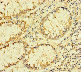 FAU Antibody