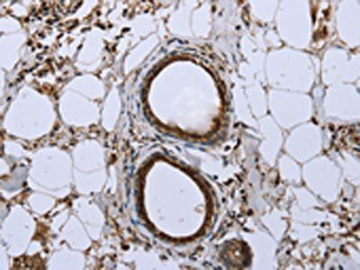 FBP1 Antibody