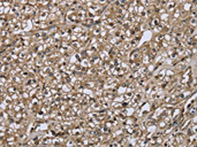FBP1 Antibody