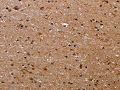 FBP2 Antibody