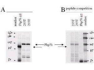 Fbp5B antibody