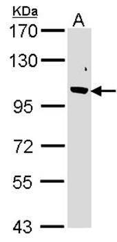 Fbp5B antibody