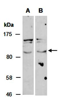 FBW7 antibody