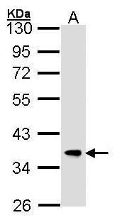 FBXL12 Rabbit Polyclonal Antibody
