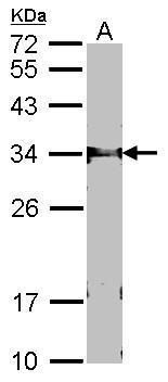 FBXL12 Rabbit Polyclonal Antibody