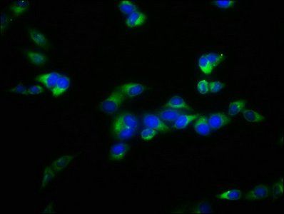 FBXL2 Antibody