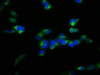 FBXL2 antibody