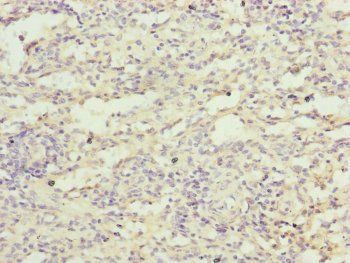 FBXL5 Antibody