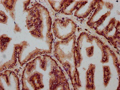 FBXO10 Antibody