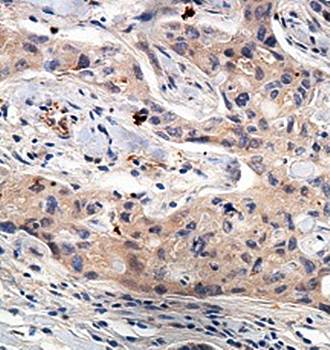 FBXO10 Rabbit Polyclonal Antibody