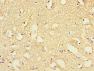 FBXO2 Antibody