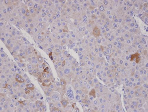 FBXO2 antibody [C2C3], C-term