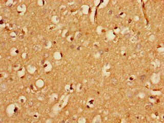 FBXO25 Antibody