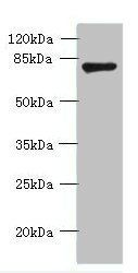 FBXO30 Antibody