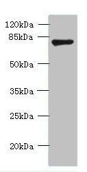 FBXO30 antibody