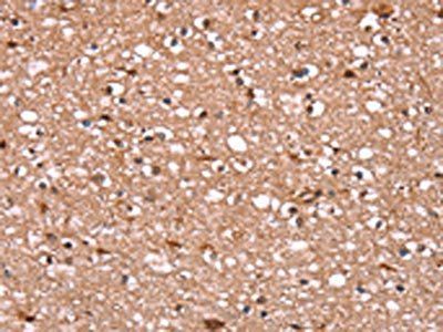 FBXO31 Antibody