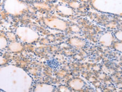 FBXO32 antibody