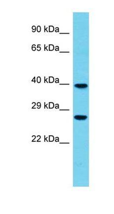 FBXO44 antibody