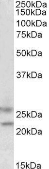 Goat anti-FBXO44 Antibody