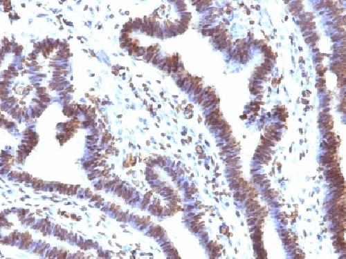 EMI1 (Early Mitotic Inhibitor-1) Antibody